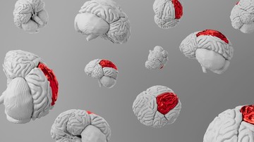 Природа мигрени: от нейробиологии до подавленных эмоций